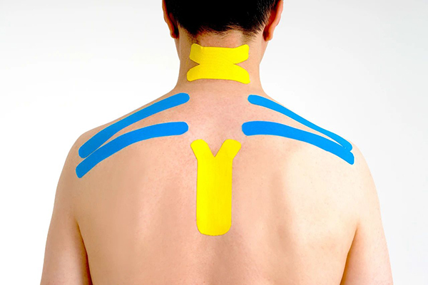What kind of physical condition is kinesiology tape suitable for?