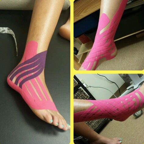 How to apply kinesiology tape to ankle?
