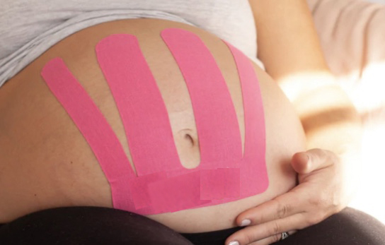 Is kinesiology tape safe for pregnancy?